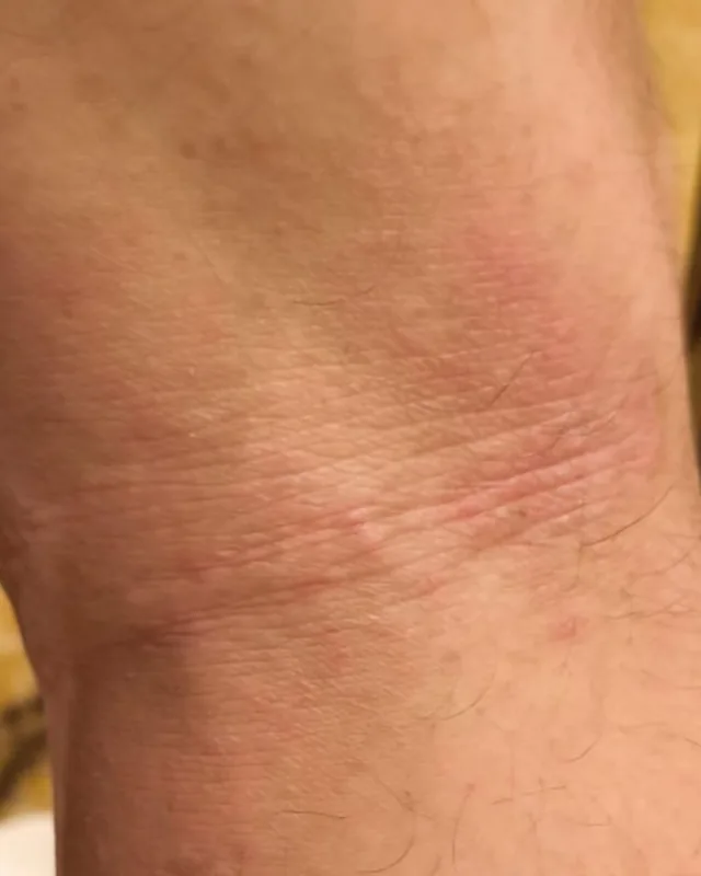 Close crop of skin behind the knee in the Day 28 photograph