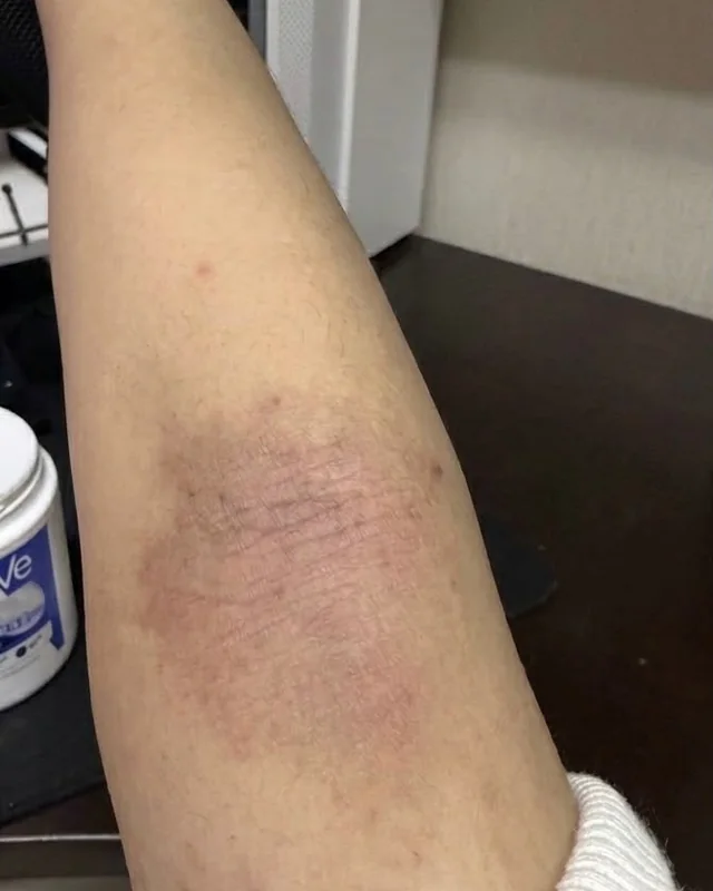 Right arm in the photograph taken on 15 December 2025